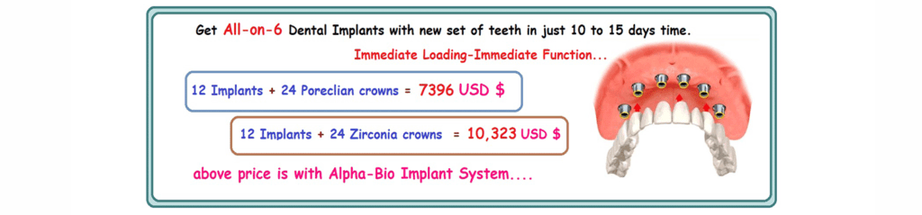 All-On-6 Dental Implants