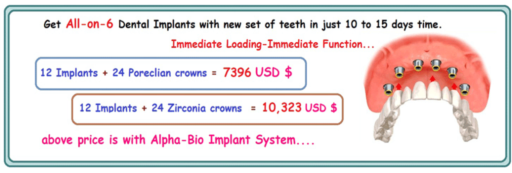 all on 6 dental implants